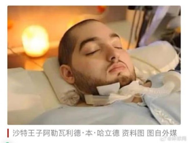 上海杠杆配资2025年 沙特沉睡王子因车祸昏迷20年后去世 生命终章闭幕